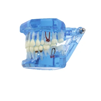 Dentare Dinți Model Preda Studiul Oral Implant Restaurarea & Patologie M2001 Albastru  10